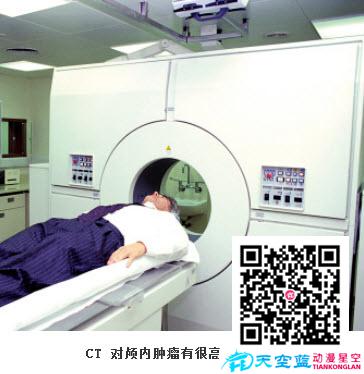 CT能檢查什么病？.jpg