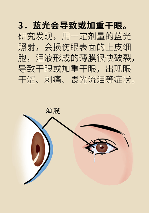 防藍光眼睛保護是怎么回事？