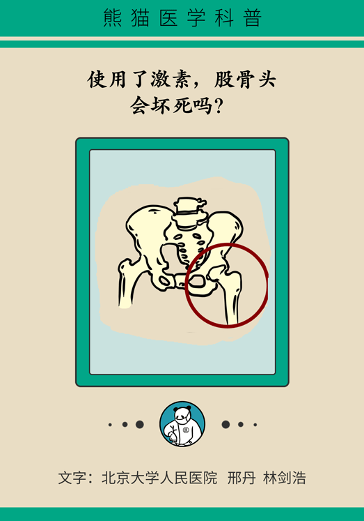 激素會帶來股骨頭壞死的后遺癥嗎？