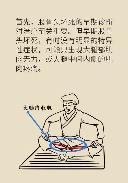 激素會帶來股骨頭壞死的后遺癥嗎？