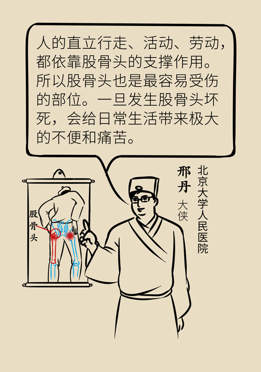 激素會帶來股骨頭壞死的后遺癥嗎？