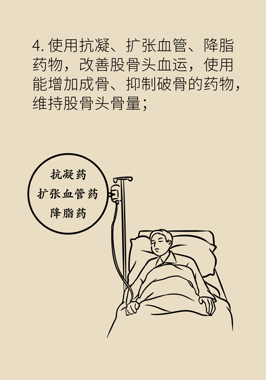激素會帶來股骨頭壞死的后遺癥嗎？