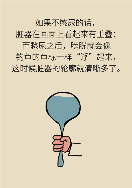 前列腺肥大了還能縮小嗎？