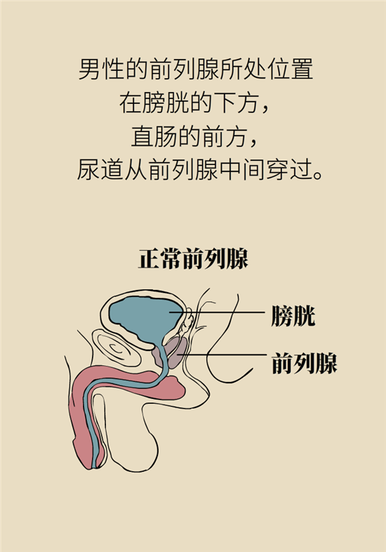 前列腺肥大了還能縮小嗎？