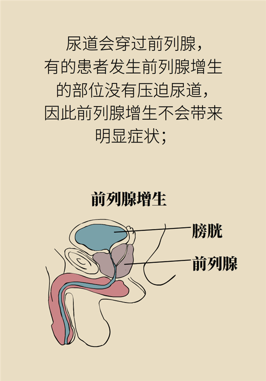 前列腺肥大了還能縮小嗎？