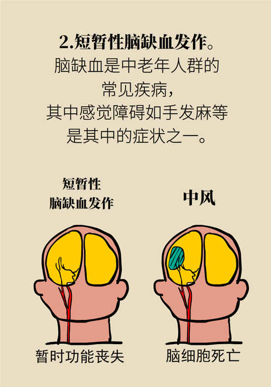 無(wú)緣無(wú)故的手麻，這是身體發(fā)出的什么信號(hào)？