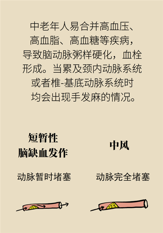 無(wú)緣無(wú)故的手麻，這是身體發(fā)出的什么信號(hào)？