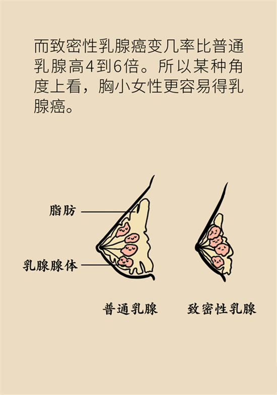 胸小是不是就不會患乳腺癌？