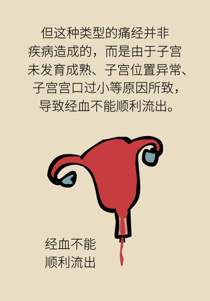 生孩子后痛經(jīng)會消失，是真的嗎？