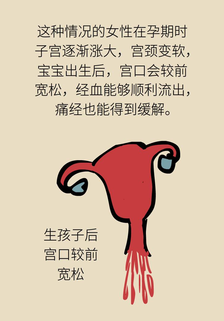 生孩子后痛經(jīng)會消失，是真的嗎？