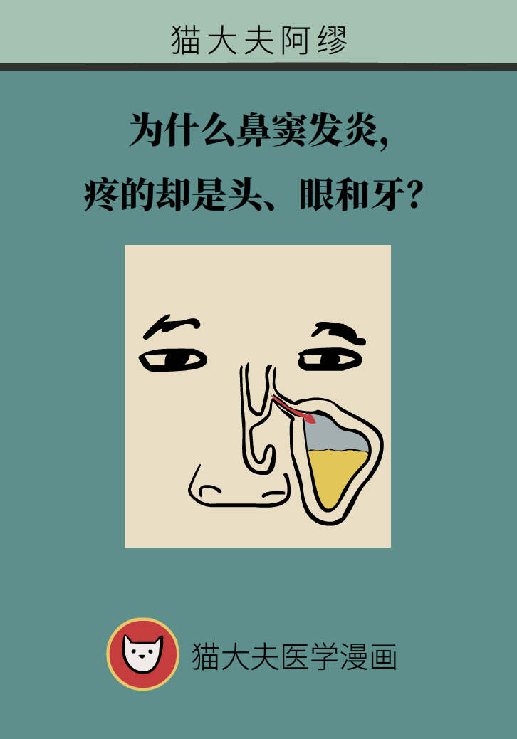 為什么鼻竇發(fā)炎，疼的卻是頭、眼和牙？