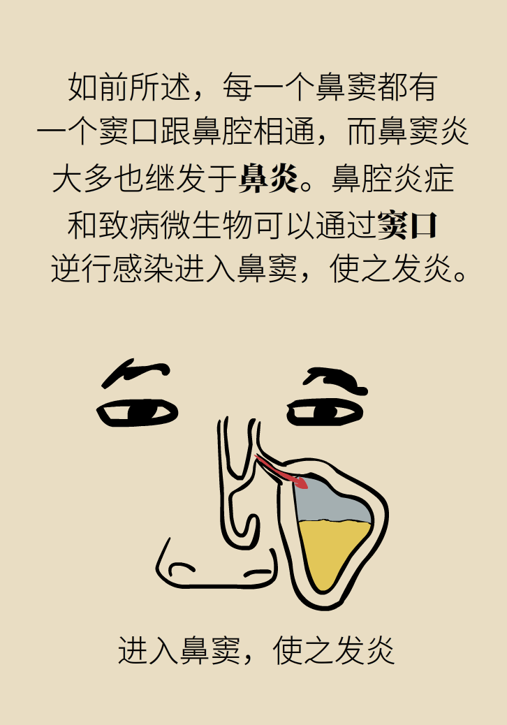 為什么鼻竇發(fā)炎，疼的卻是頭、眼和牙？