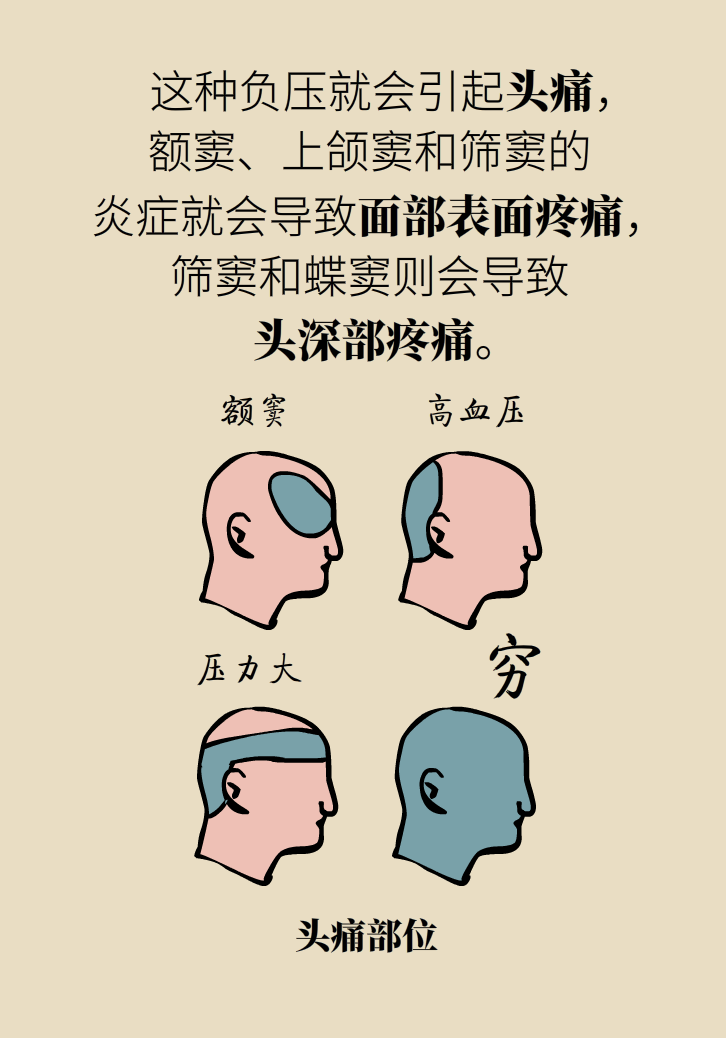 為什么鼻竇發(fā)炎，疼的卻是頭、眼和牙？