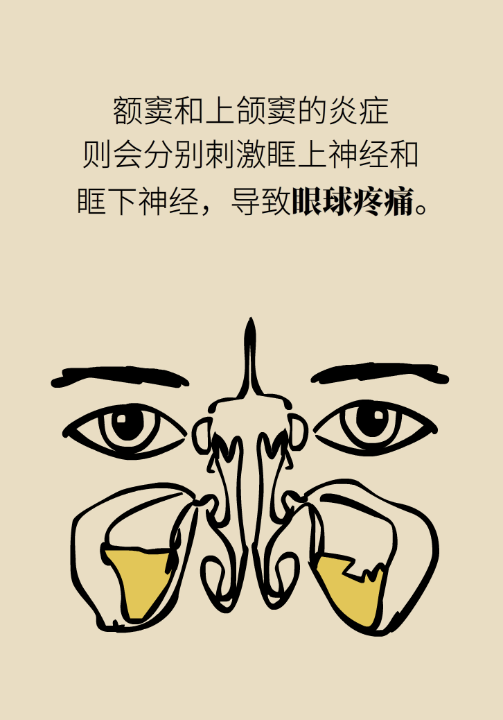 為什么鼻竇發(fā)炎，疼的卻是頭、眼和牙？