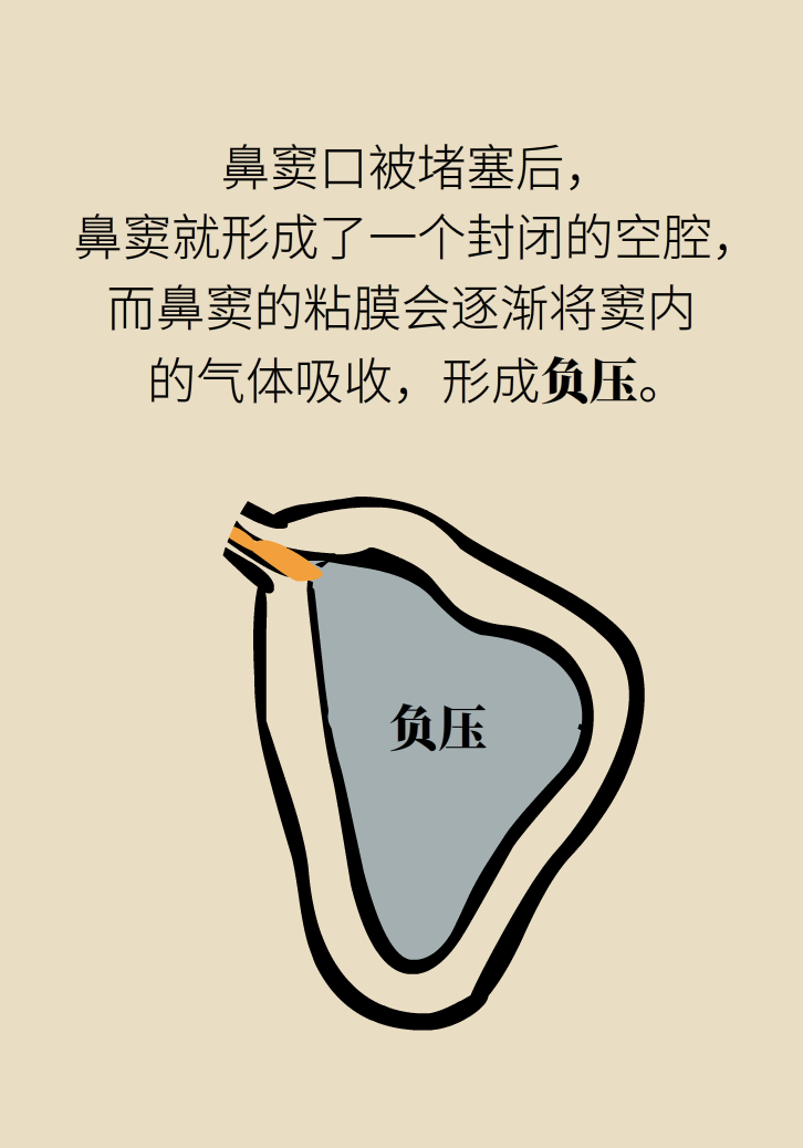 為什么鼻竇發(fā)炎，疼的卻是頭、眼和牙？