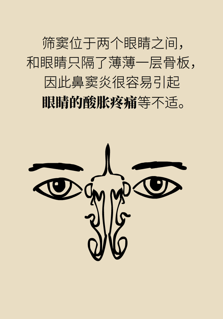 為什么鼻竇發(fā)炎，疼的卻是頭、眼和牙？