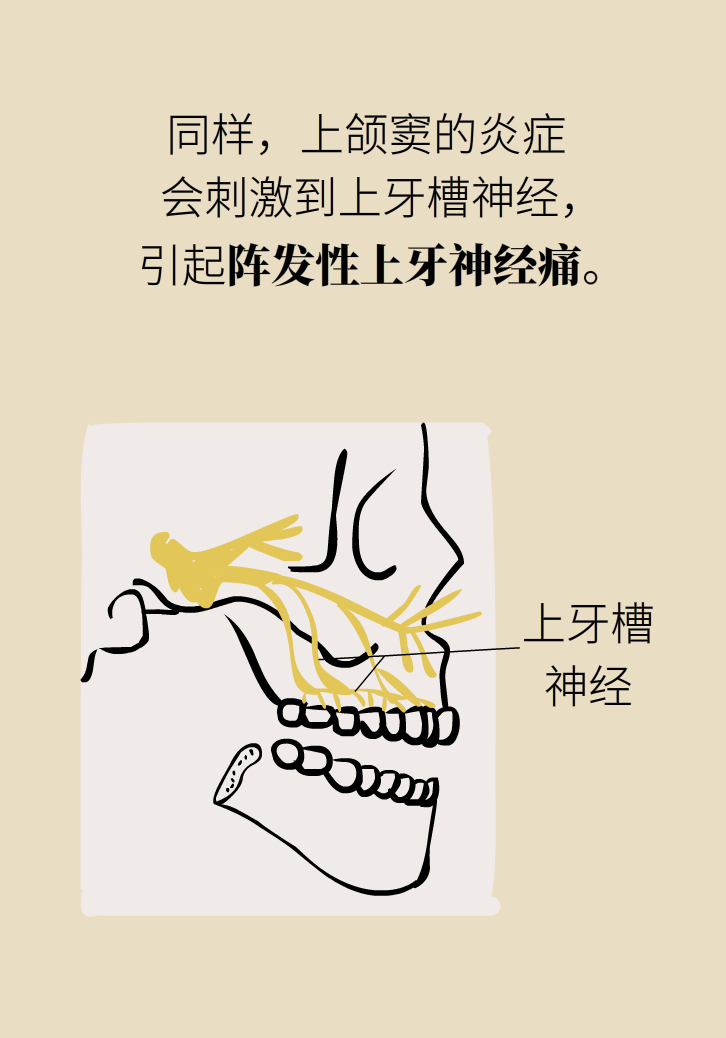 為什么鼻竇發(fā)炎，疼的卻是頭、眼和牙？