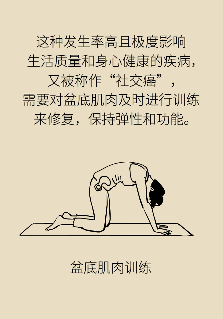 選擇剖腹產(chǎn)，就能避免盆底肌損傷嗎？