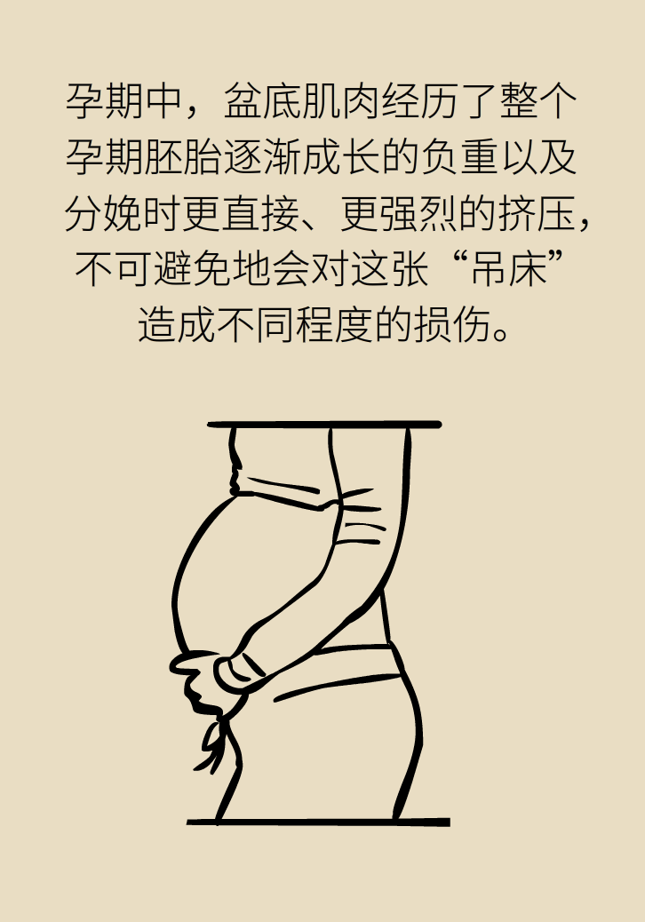 選擇剖腹產(chǎn)，就能避免盆底肌損傷嗎？