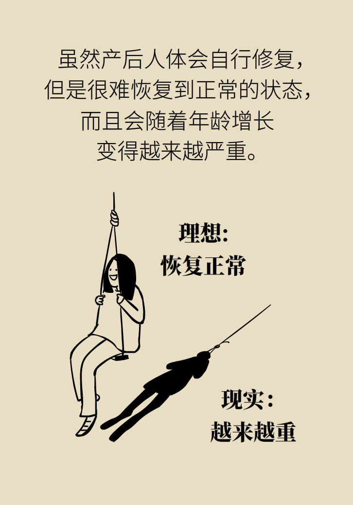 選擇剖腹產(chǎn)，就能避免盆底肌損傷嗎？