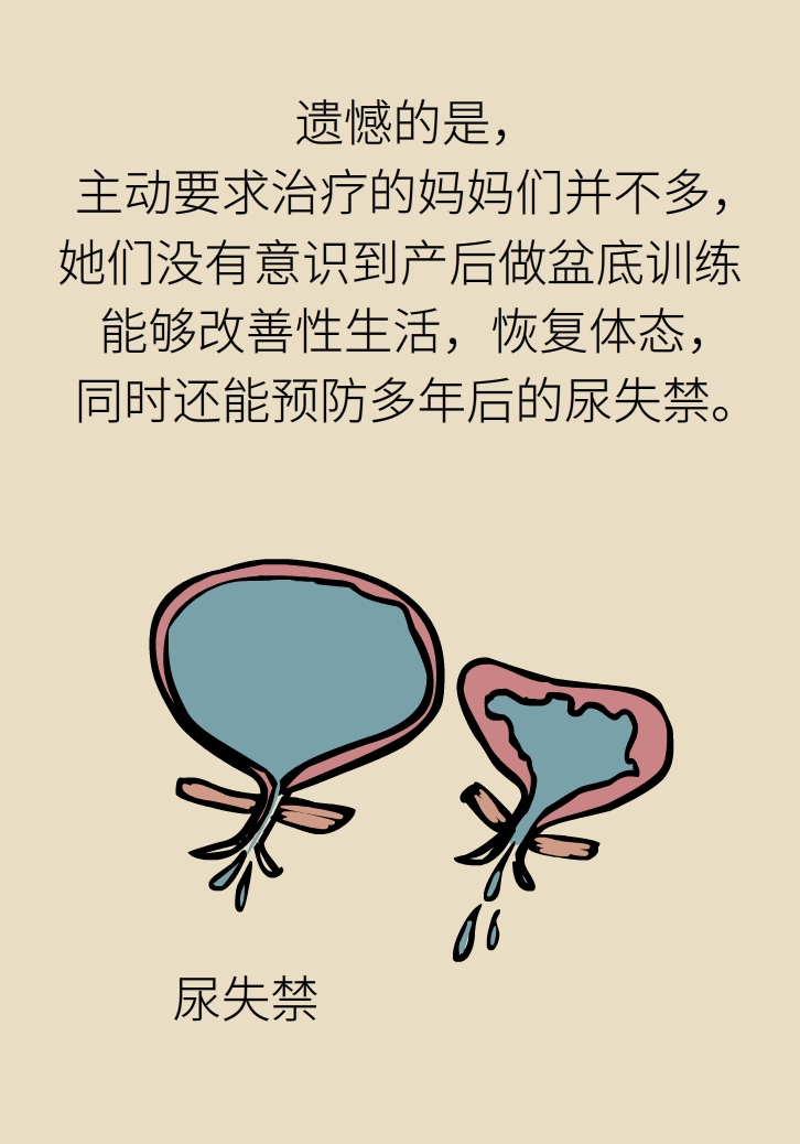 選擇剖腹產(chǎn)，就能避免盆底肌損傷嗎？