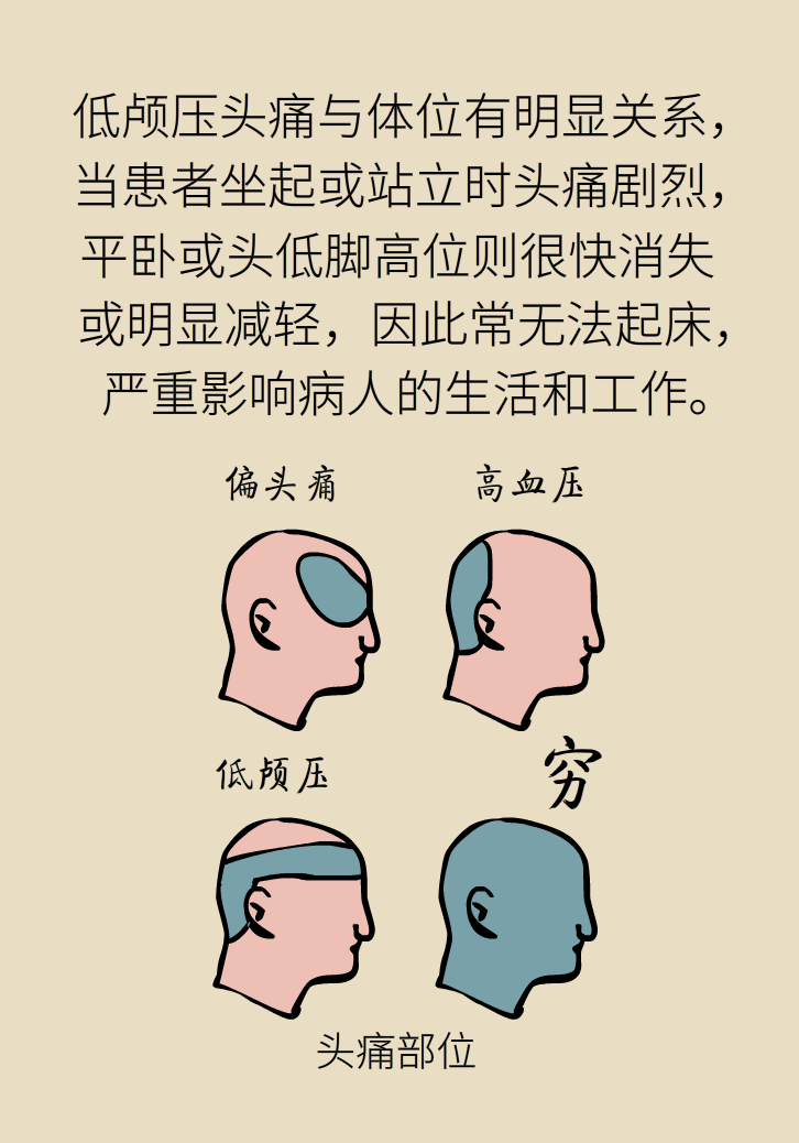 練瑜伽把腦脊液拉漏了！常見(jiàn)的“瑜伽病”你知道多少