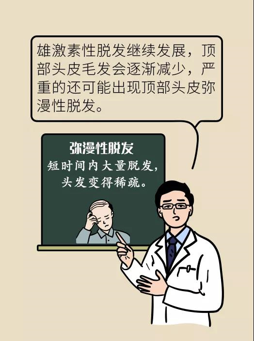 頭發(fā)一把一把地掉？搞明白根源才能對(duì)癥下藥
