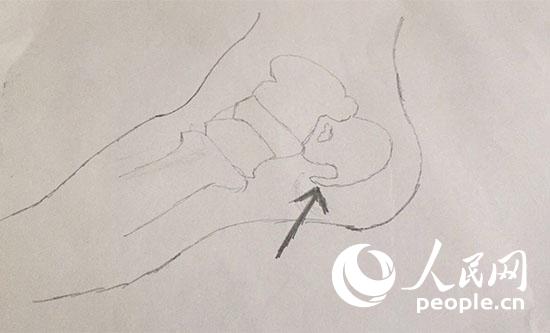 腿腳疼痛就買膏藥治骨刺？別被不良商家誤導(dǎo)了