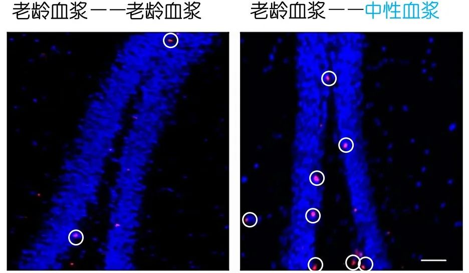 重返年輕不用大換血，只要給血液“兌點(diǎn)水”？