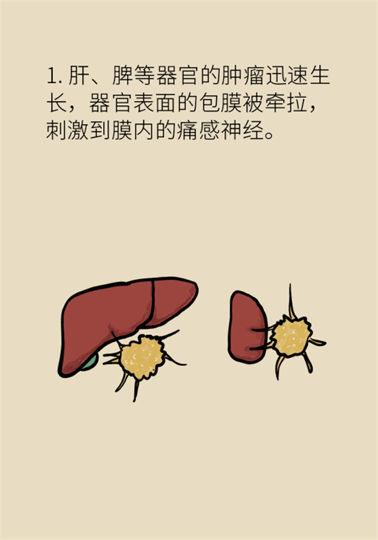 癌癥到底有多痛？需要注意這7個(gè)重點(diǎn)問題