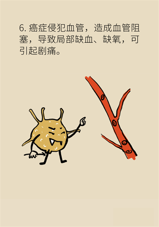 癌癥到底有多痛？需要注意這7個(gè)重點(diǎn)問題