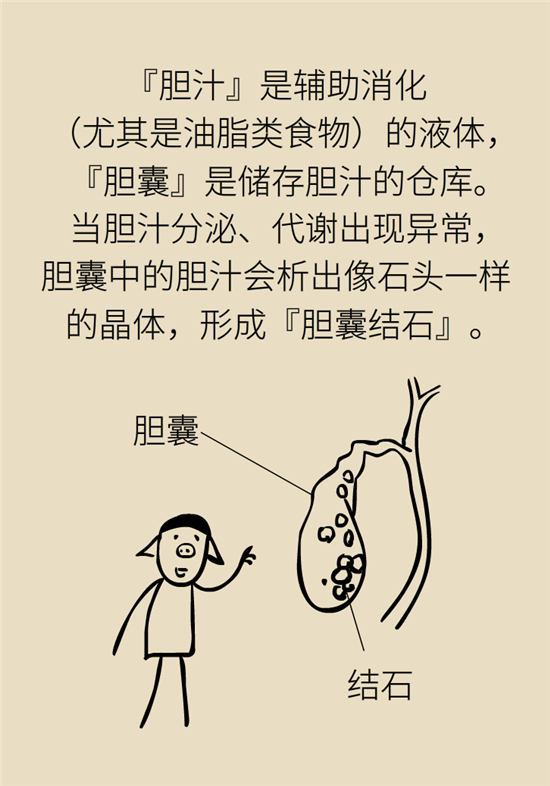 結(jié)石科普：身體里多了各種結(jié)石，應(yīng)該怎么辦？