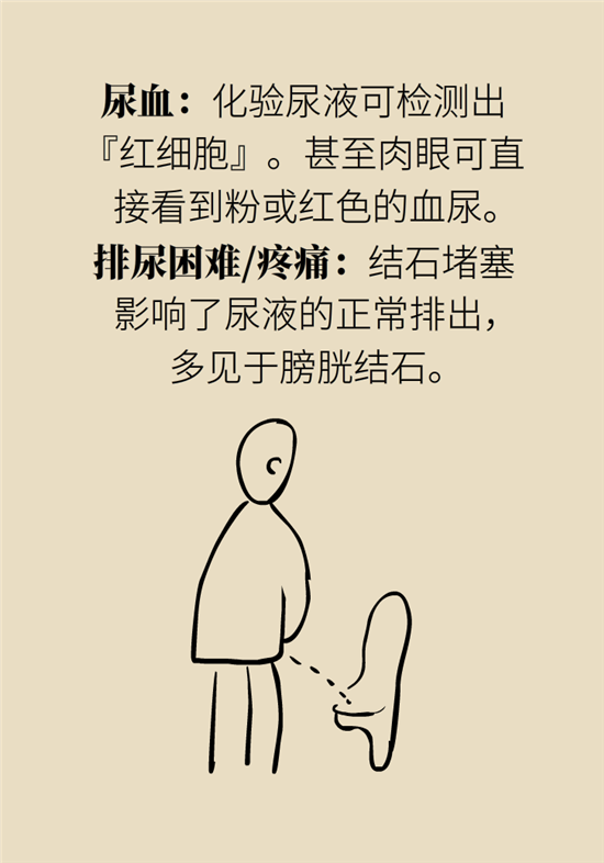 結(jié)石科普：身體里多了各種結(jié)石，應(yīng)該怎么辦？