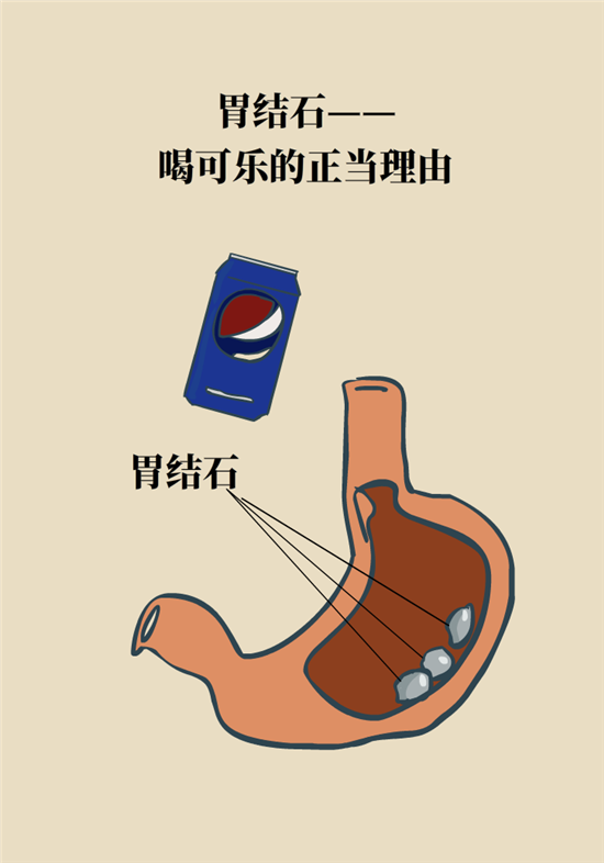 結(jié)石科普：身體里多了各種結(jié)石，應(yīng)該怎么辦？