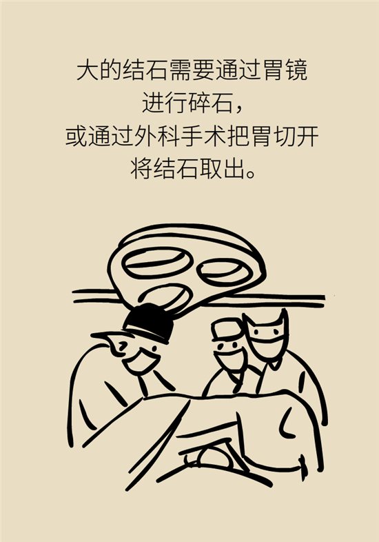 結(jié)石科普：身體里多了各種結(jié)石，應(yīng)該怎么辦？