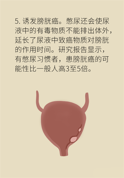 憋尿的7大危害，你真的了解嗎？