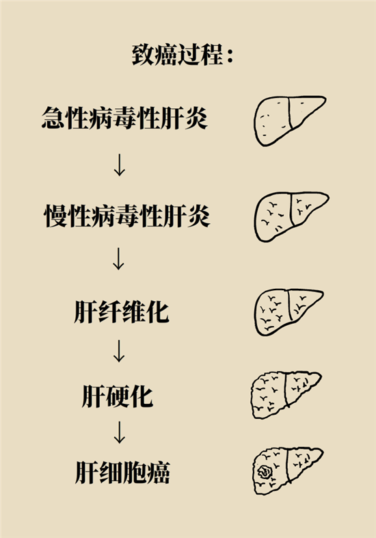 癌癥會(huì)傳染嗎？專家：這些高危因素得注意