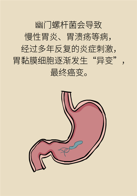 癌癥會(huì)傳染嗎？專家：這些高危因素得注意