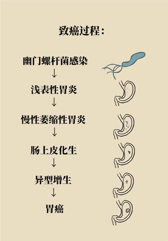 癌癥會(huì)傳染嗎？專家：這些高危因素得注意