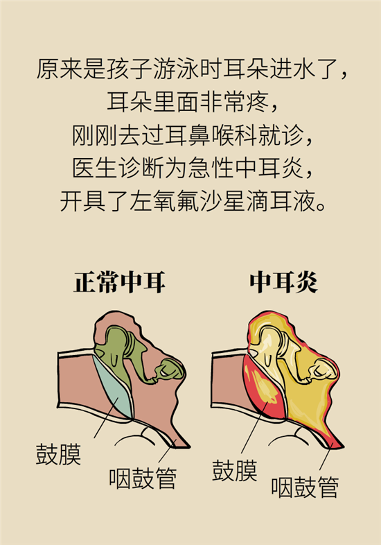 孩子游泳耳朵進水用“耳浴“？得注意這7大細節(jié)