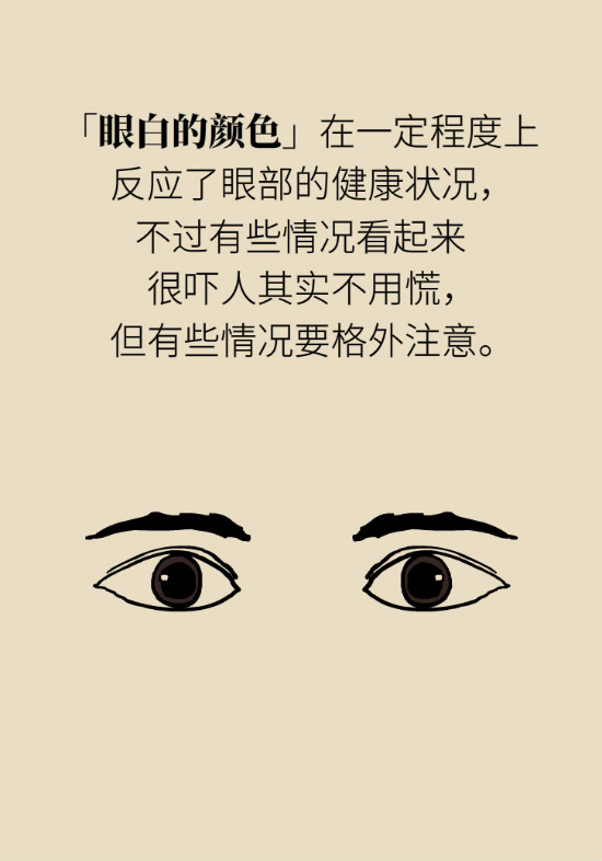 眼白有斑塊、出血要緊嗎？專家：名字唬人但問題不大