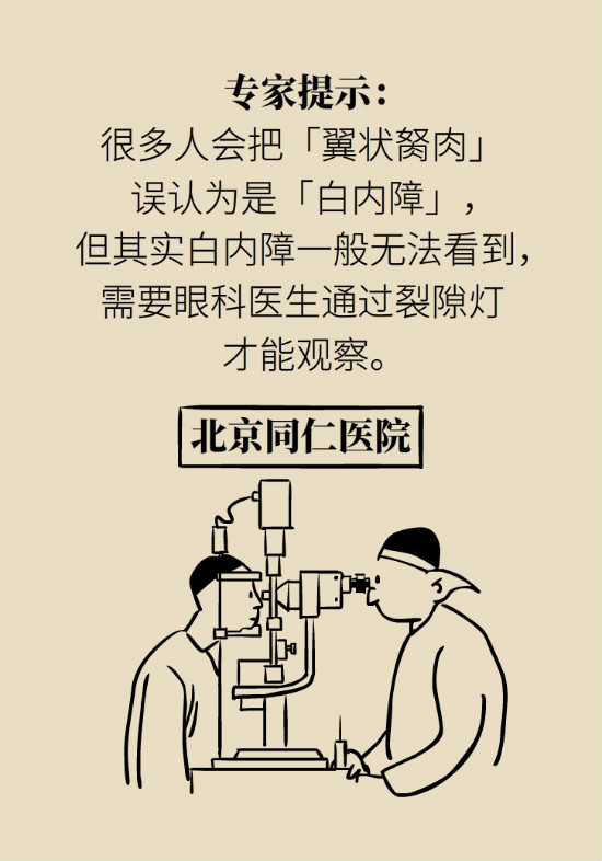 眼白有斑塊、出血要緊嗎？專家：名字唬人但問題不大