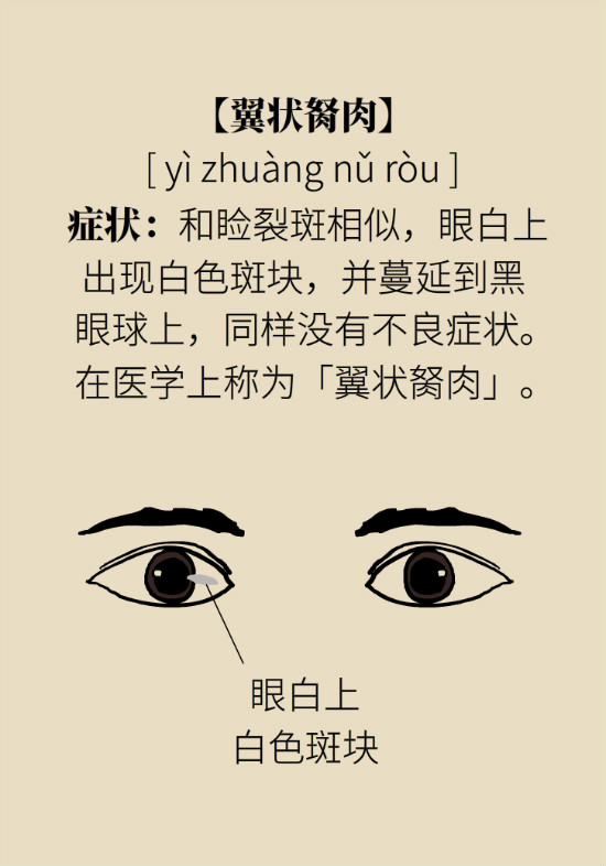 眼白有斑塊、出血要緊嗎？專家：名字唬人但問題不大