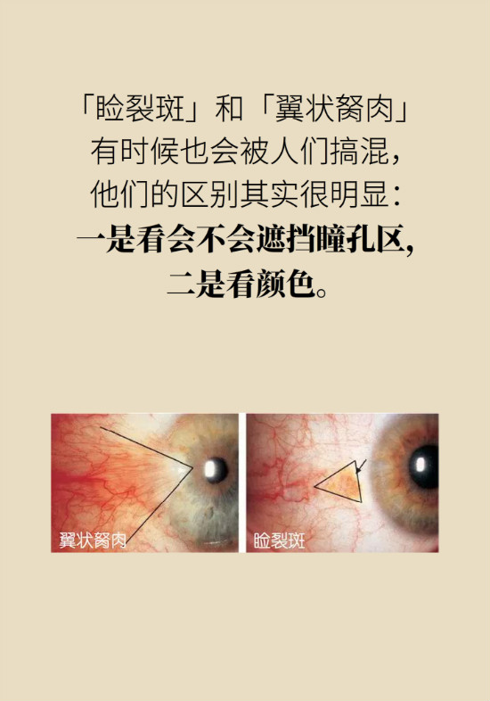 眼白有斑塊、出血要緊嗎？專家：名字唬人但問題不大