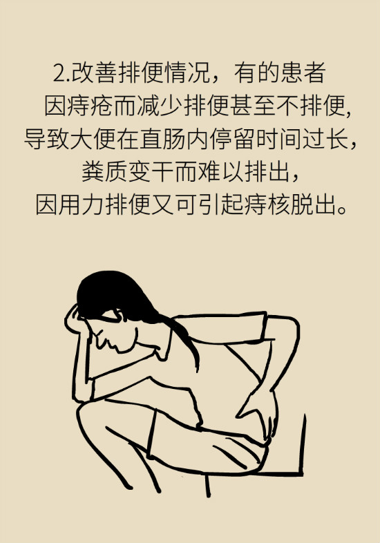 長“痔”如何久安？專家的建議來了