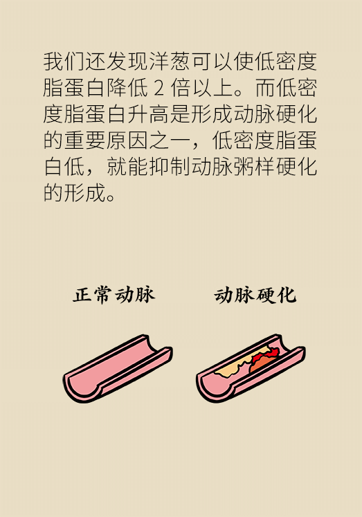 洋蔥可以預(yù)防動(dòng)脈硬化，是真的嗎？
