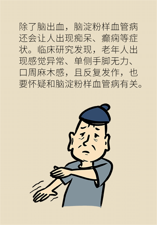 身體出現(xiàn)這些癥狀要小心，可能是腦出血發(fā)出的信號(hào)
