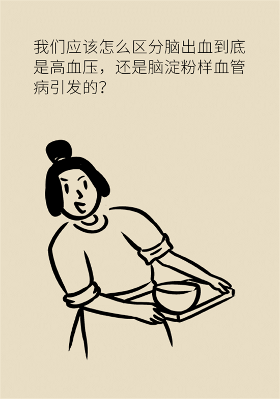 身體出現(xiàn)這些癥狀要小心，可能是腦出血發(fā)出的信號(hào)