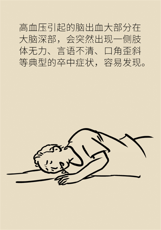 身體出現(xiàn)這些癥狀要小心，可能是腦出血發(fā)出的信號(hào)