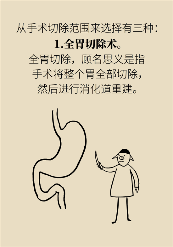 胃癌手術(shù)一定要全切胃？專家：視情況而定